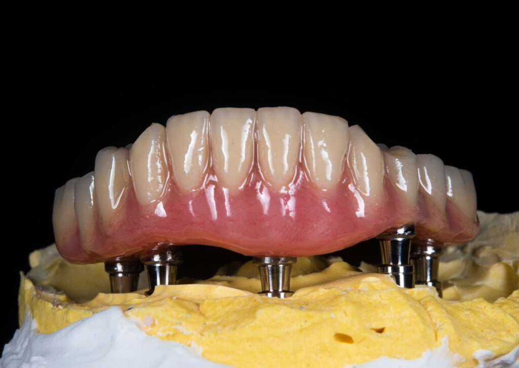 one day wall teeth